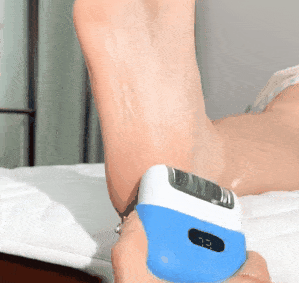 RAPEUSE DE CALLOSITÉS DES PIEDS