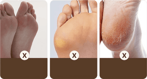 RAPEUSE DE CALLOSITÉS DES PIEDS