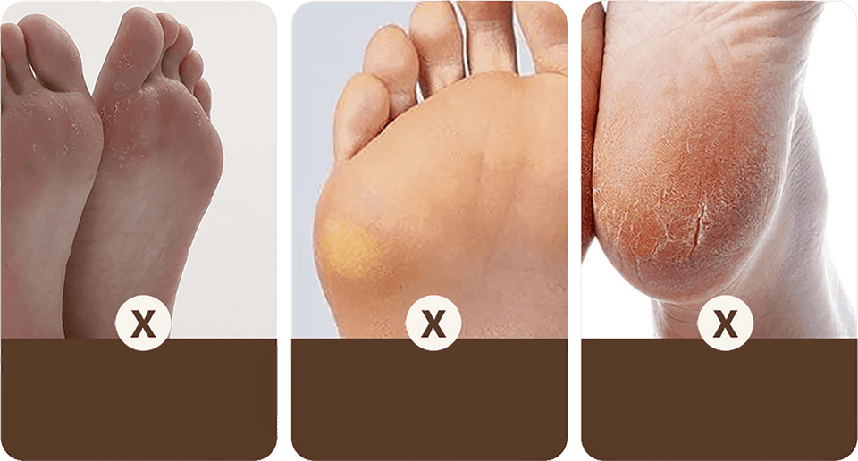 RAPEUSE DE CALLOSITÉS DES PIEDS