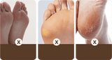 RAPEUSE DE CALLOSITÉS DES PIEDS