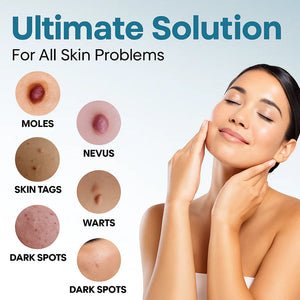 MediSkin Laser