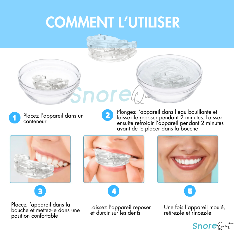SnoreQuiet™ Fini le ronflement