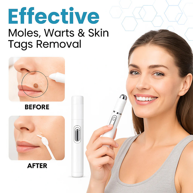 MediSkin Laser