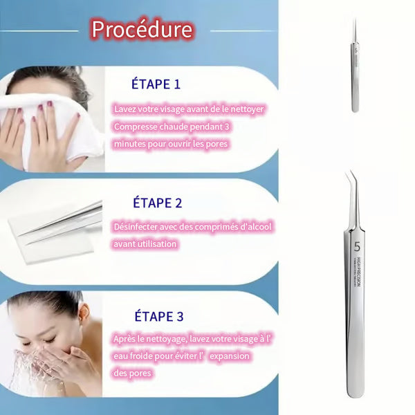 VENTE FLASH 49% DE RÉDUCTION💥 Pinces Professionnelles pour Enlever les Points Noirs du Visage