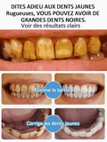 🔥Dentifrice SP-6 pour la gestion de la santé bucco-dentaire, haleine fraîche